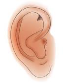 Le malléus est un petit os de l'oreille interne. Comment l'appelle-t-on généralement ?